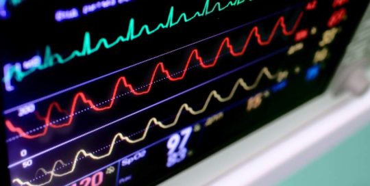 ekg-electrocardiography-brevard-county